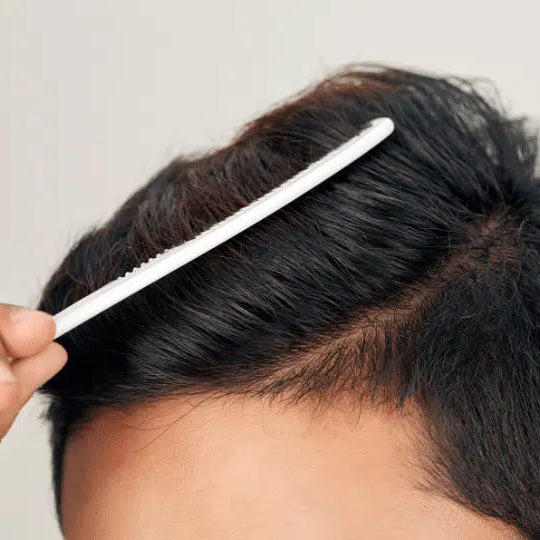 Integratore Rame e Zinco: i minerali che servono ai tuoi capelli